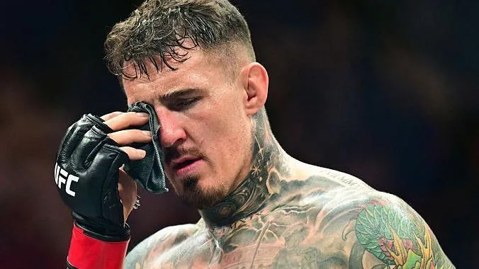 UFC｜湯姆．阿斯皮納右眼幾乎失明！UFC321爭議後仍無法視物　父親坦言：「情況很糟」